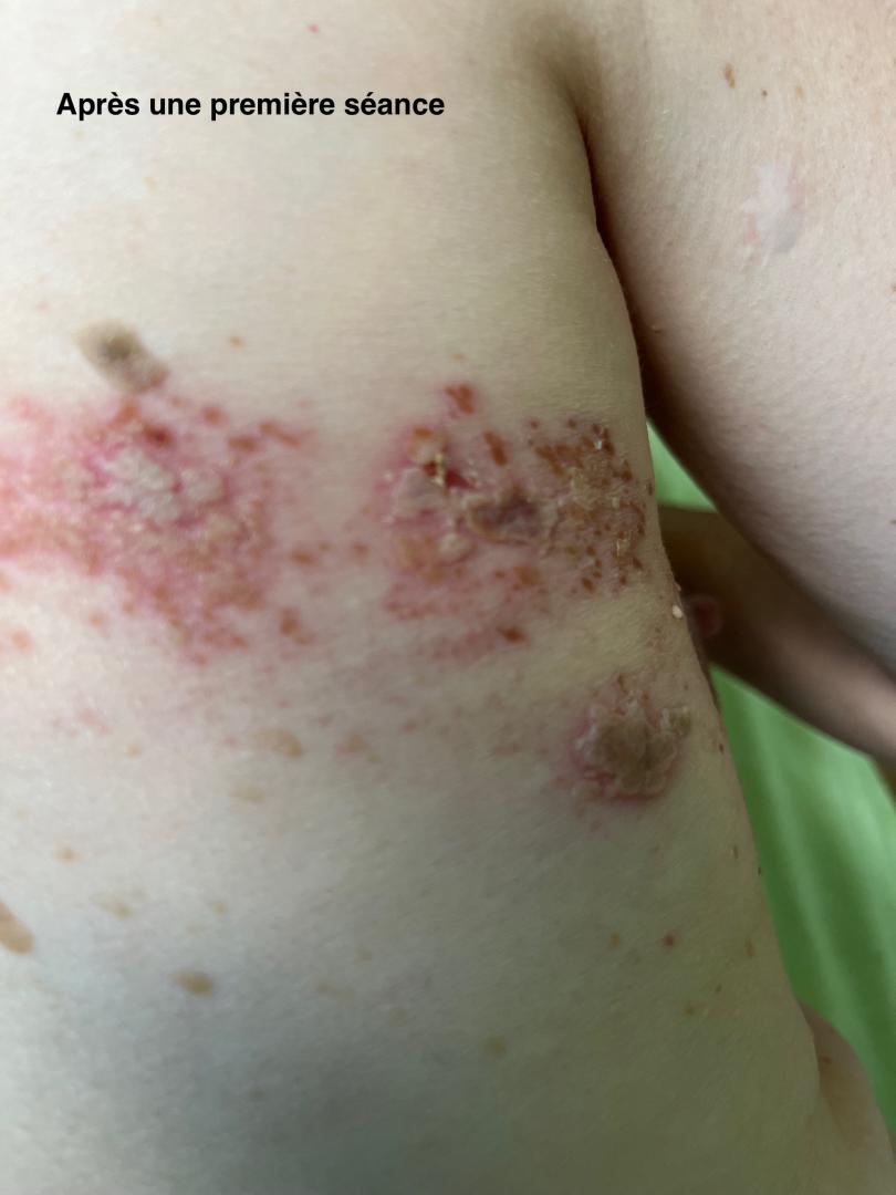 Zona du dos après une séance